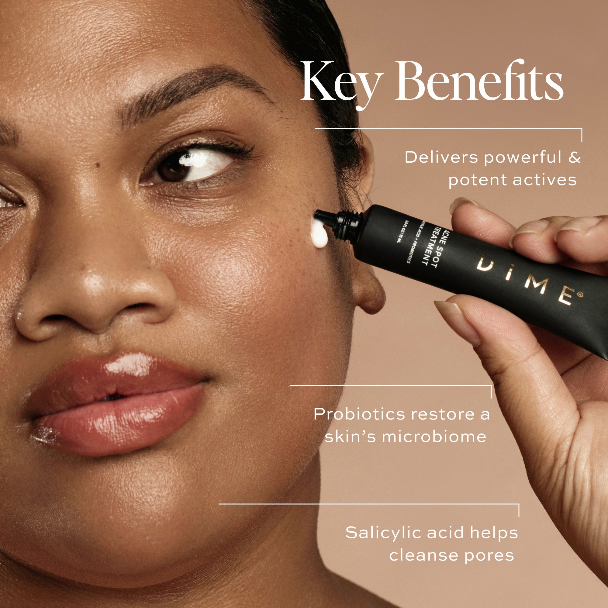 Acne Spot Treatment
