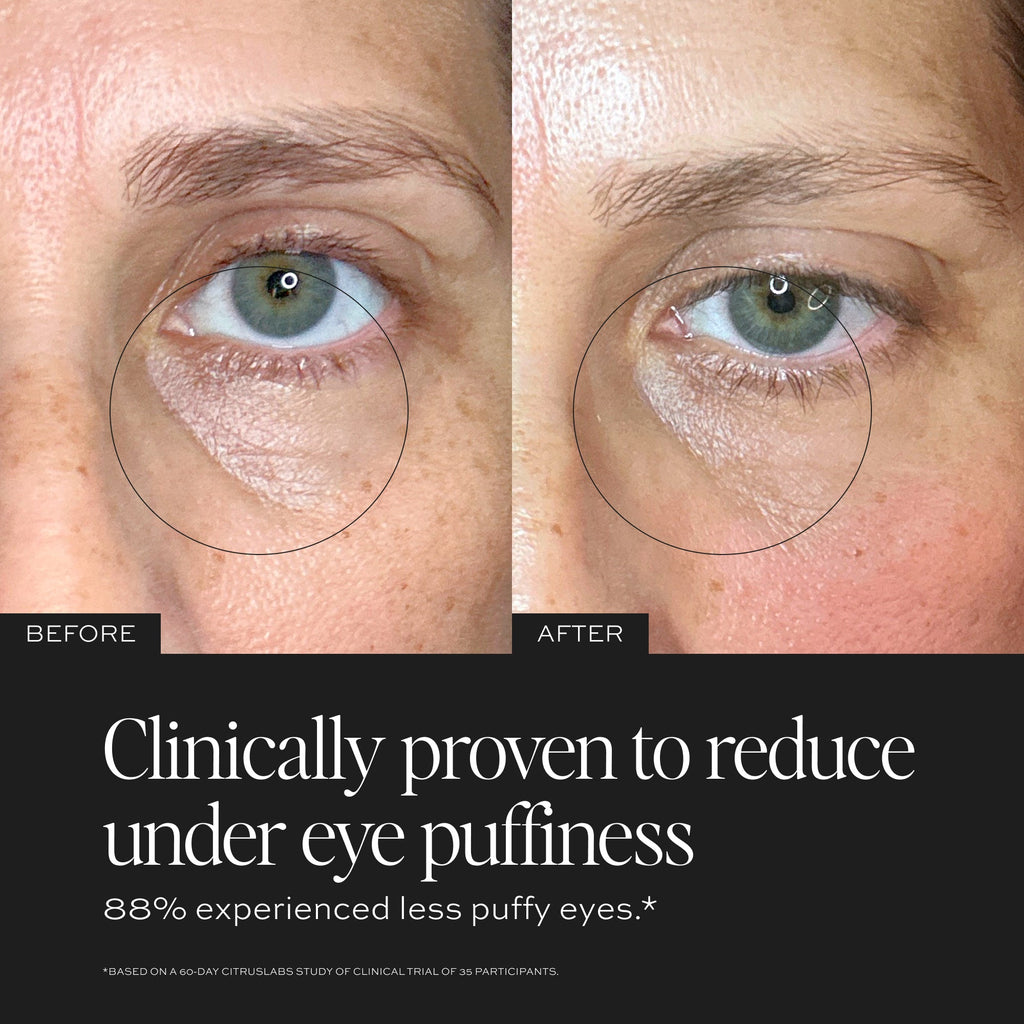 Luminosity™ Eye Serum