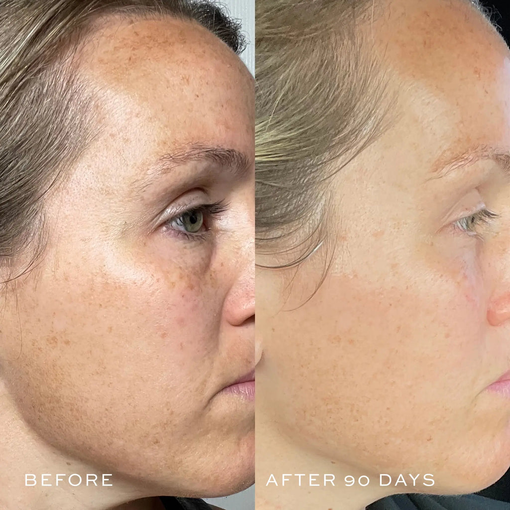 TBT® Serum (Anti-Aging Serum)